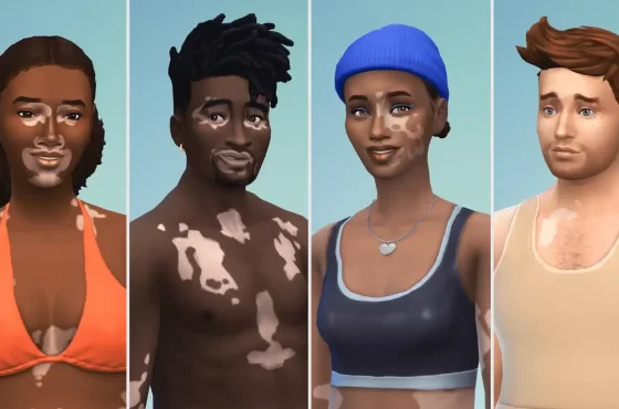 《The Sims 4》與 Winnie Harlow 一起推出遊戲內白癜風（Vitiligo）皮膚特色