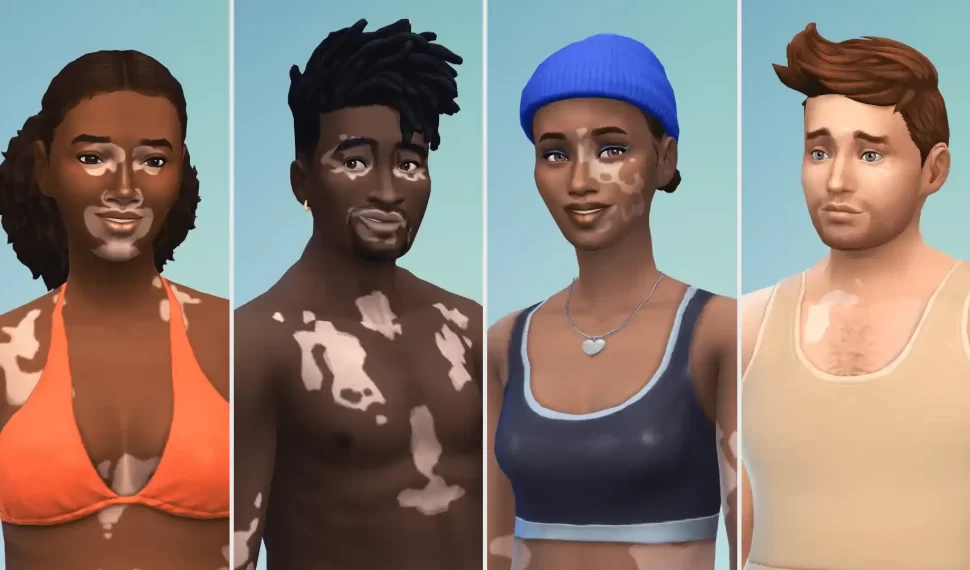 《The Sims 4》與 Winnie Harlow 一起推出遊戲內白癜風（Vitiligo）皮膚特色